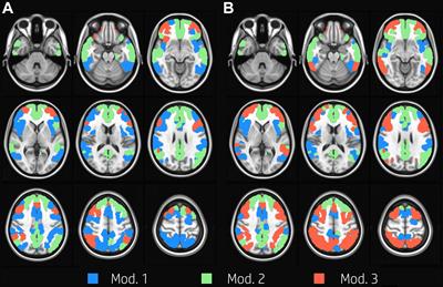 Brain Network Modularity During a Sustained Working-Memory Task